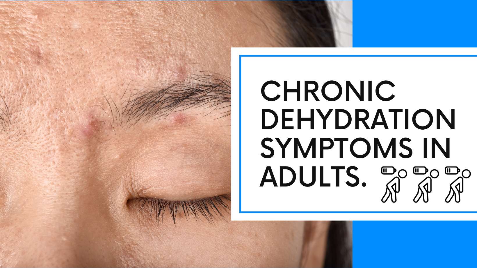 10 Signs of Dehydration You Shouldn’t Ignore | 7 Minute Read What Are The Signs Of Dehydration In Adults